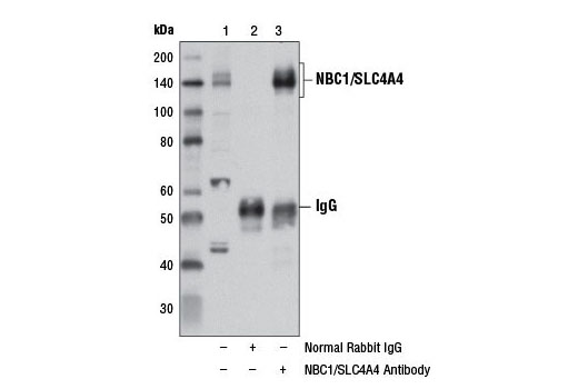 Immunoprecipitation Image 1: NBC1/SLC4A4 Antibody