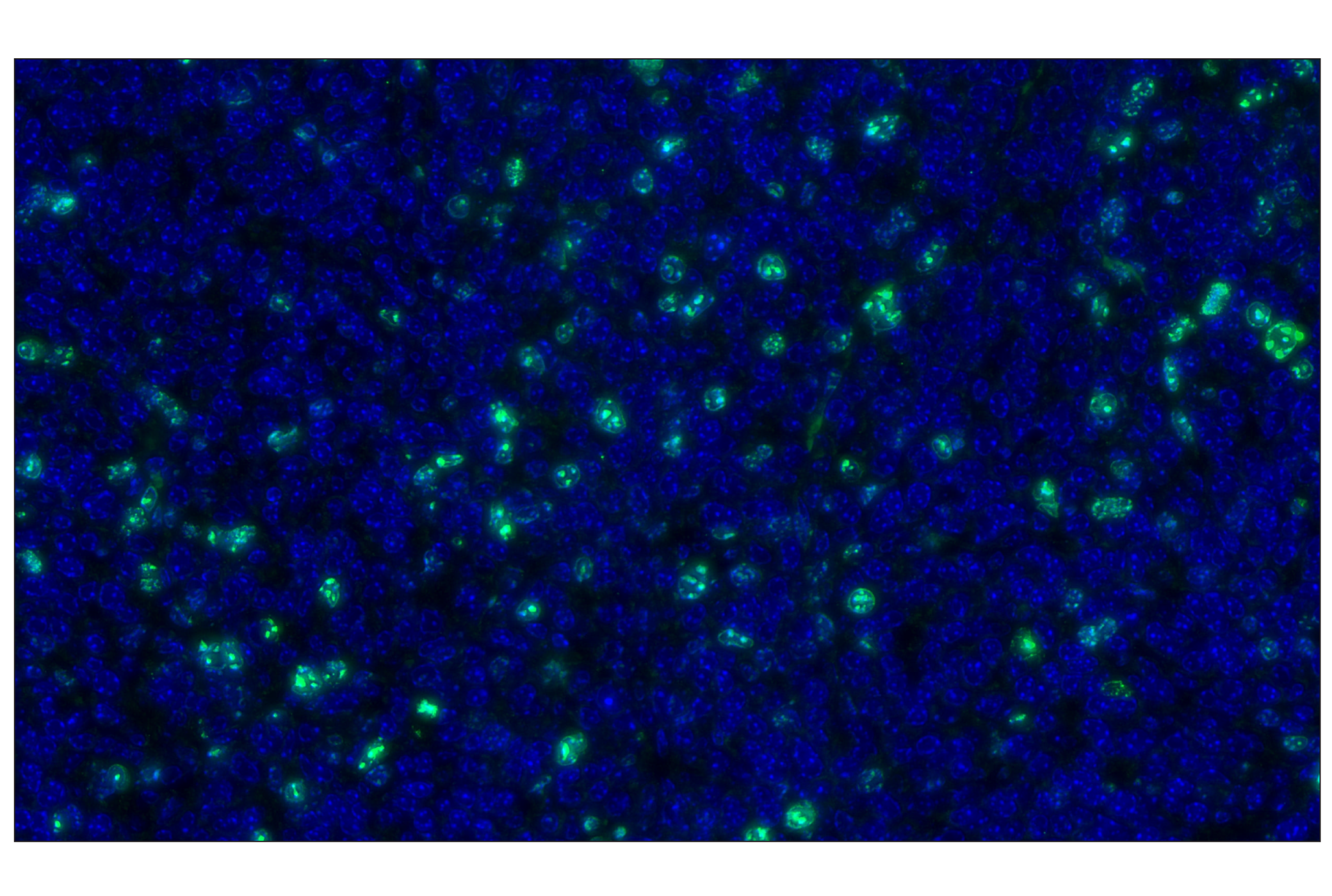 Immunohistochemistry Image 1: Ki-67 (D3B5) Rabbit mAb (Alexa Fluor® 488 Conjugate)