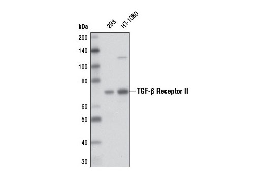 Western Blotting Image 1: TGF-β Receptor II (D3A1) Rabbit mAb
