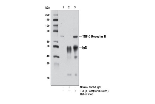 Immunoprecipitation Image 1: TGF-β Receptor II (D3A1) Rabbit mAb