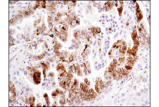 Immunohistochemistry Image 2: Phospho-NDRG1 (Ser330) (D3A12) Rabbit mAb