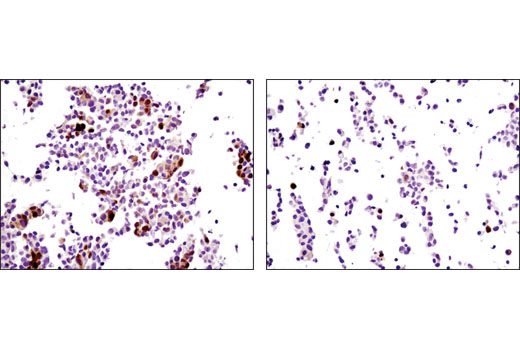 Immunohistochemistry Image 3: Phospho-NDRG1 (Ser330) (D3A12) Rabbit mAb