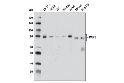 Western Blotting Image 1: WIP1 (D4F7) Rabbit mAb