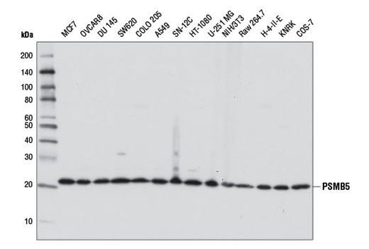 Western Blotting Image 1: PSMB5 Antibody