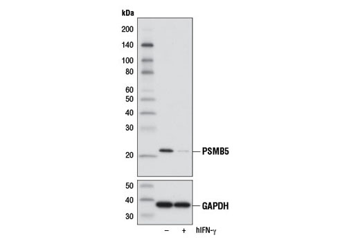 Western Blotting Image 3: PSMB5 Antibody
