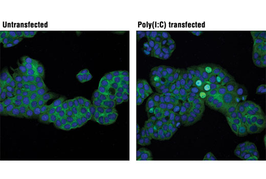Immunofluorescence Image 1: IRF-3 (D6I4C) XP® Rabbit mAb