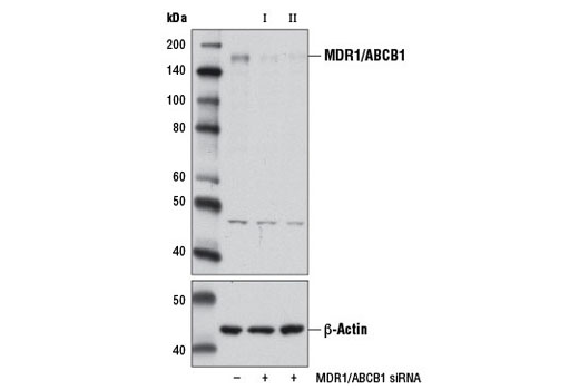  Image 1: SignalSilence® MDR1/ABCB1 siRNA II