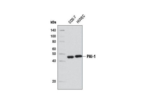  Image 1: Senescence Associated Secretory Phenotype (SASP) Antibody Sampler Kit