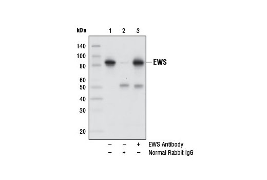 Immunoprecipitation Image 1: EWS Antibody