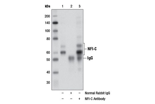 Immunoprecipitation Image 1: NFI-C Antibody