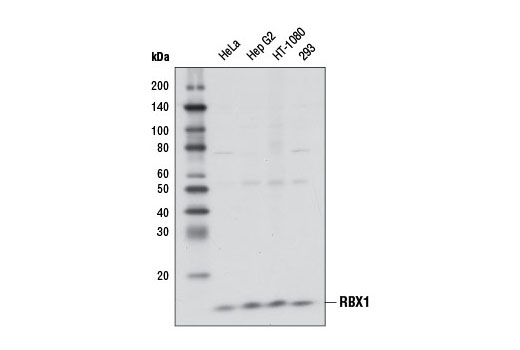  Image 1: CRL4/CRBN Targeted Protein Degradation Complex Antibody Sampler Kit