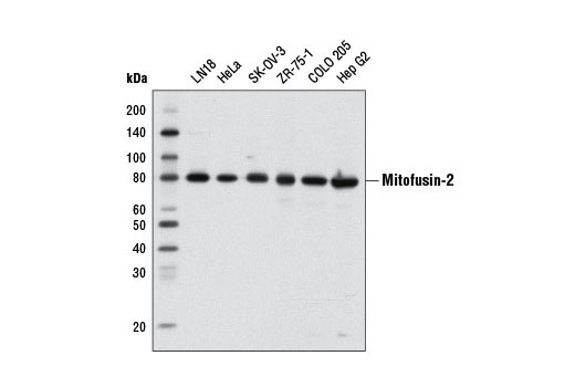  Image 1: Mitochondrial Dynamics Antibody Sampler Kit II