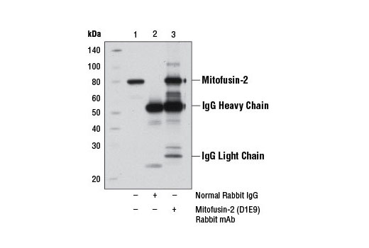Immunoprecipitation Image 1: Mitofusin-2 (D1E9) Rabbit mAb