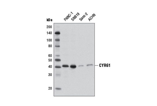 CYR61 Antibody | Cell Signaling Technology
