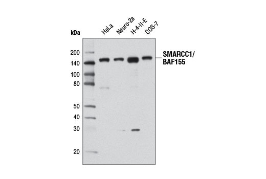  Image 1: BAF Complex Antibody Sampler Kit