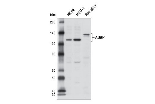 Western Blotting Image 1: ADAP Antibody