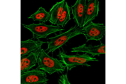 Immunofluorescence Image 1: Tri-Methyl-Histone H3 (Lys4) (C42D8) Rabbit mAb (Alexa Fluor® 555 Conjugate)