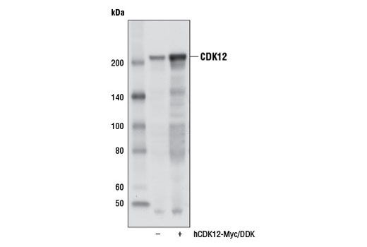Western Blotting Image 2: CDK12 Antibody