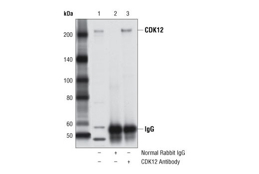 Immunoprecipitation Image 1: CDK12 Antibody