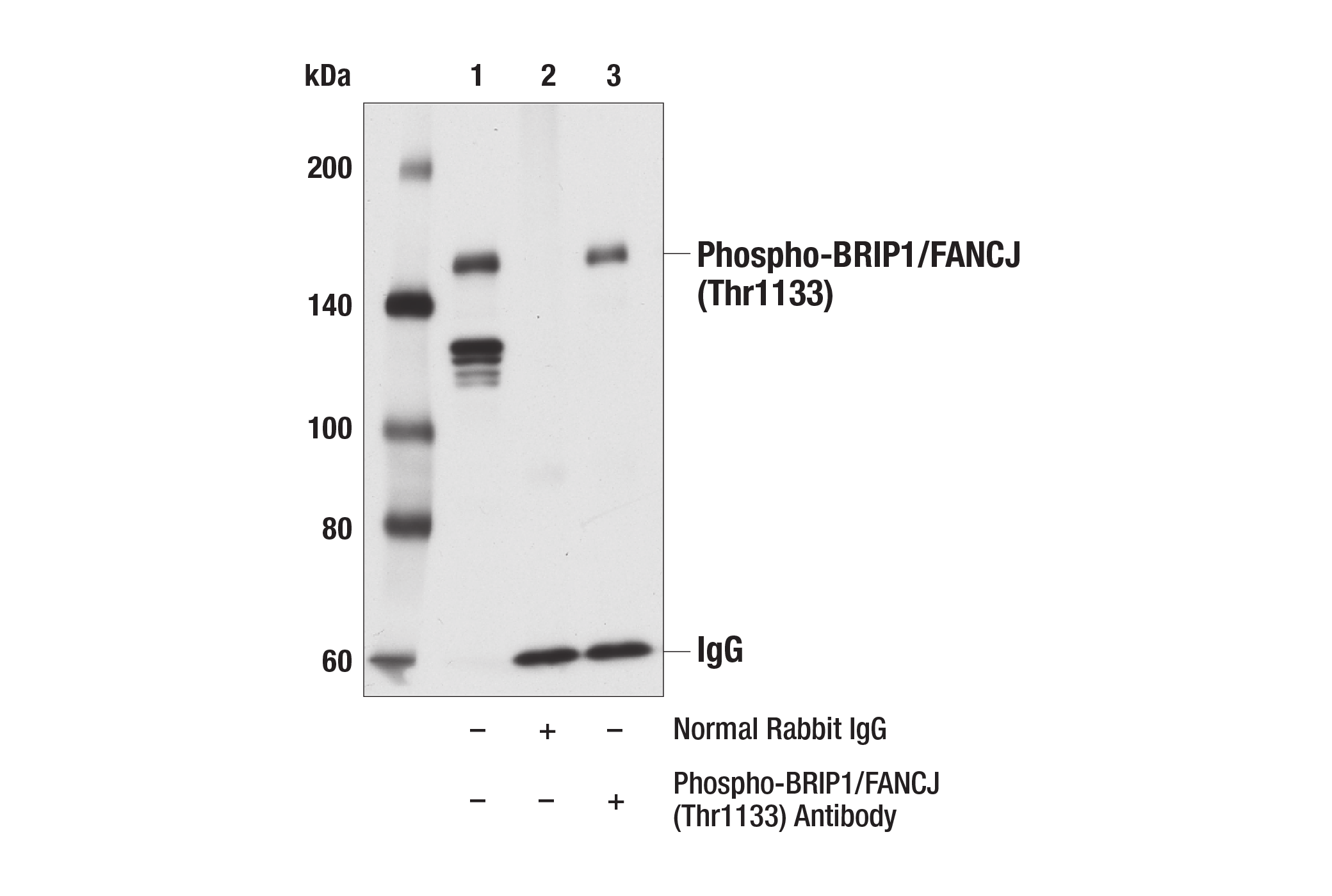 Immunoprecipitation Image 1: Phospho-BRIP1/FANCJ (Thr1133) Antibody