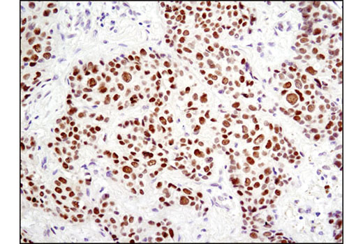  Image 19: Notch Activated Targets Antibody Sampler Kit