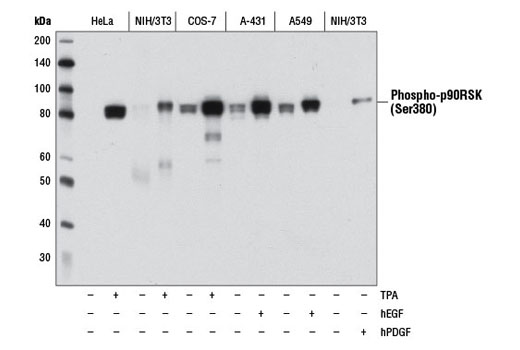  Image 1: Phospho-Erk1/2 Pathway Antibody Sampler Kit