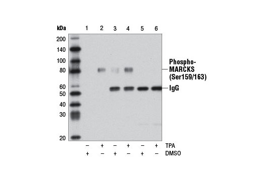 Immunoprecipitation Image 1: Phospho-MARCKS (Ser159/163) (D13D2) Rabbit mAb