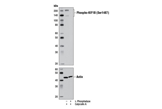 Western Blotting Image 1: Phospho-KIF1B (Ser1487) Antibody