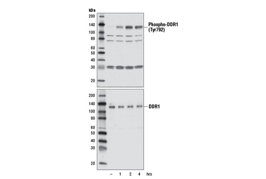 Western Blotting Image 1: Phospho-DDR1 (Tyr792) Antibody