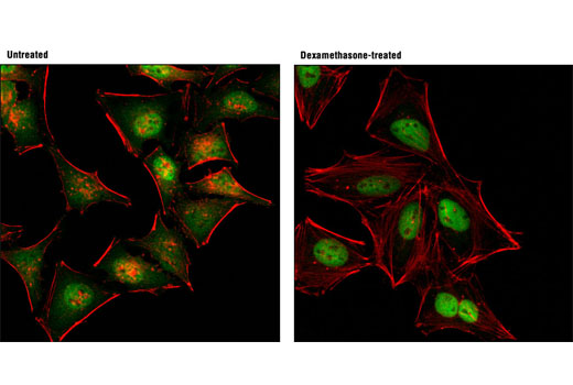 Immunofluorescence Image 1: Glucocorticoid Receptor (D8H2) XP® Rabbit mAb (Alexa Fluor® 488 Conjugate)