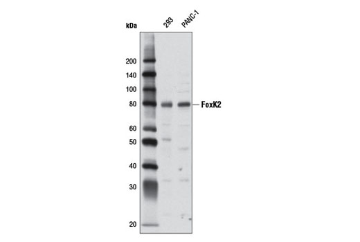 Western Blotting Image 1: FoxK2 Antibody