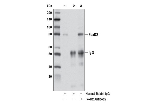 Immunoprecipitation Image 1: FoxK2 Antibody
