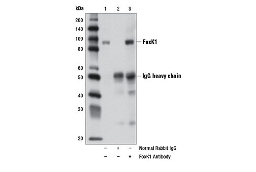 Immunoprecipitation Image 1: FoxK1 Antibody