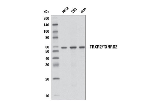 Western Blotting Image 1: TRXR2/TXNRD2 (3F2-E12-F10) Mouse mAb