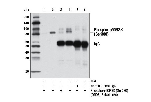 Immunoprecipitation Image 1: Phospho-p90RSK (Ser380) (D5D8) Rabbit mAb