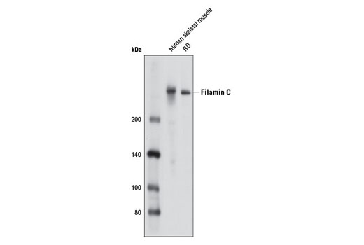 Western Blotting Image 1: Filamin C Antibody