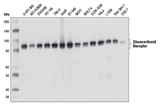 Western Blotting Image 1: Glucocorticoid Receptor (D6H2L) XP® Rabbit mAb