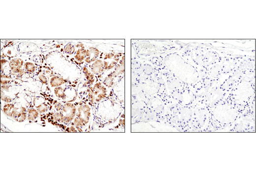 Immunohistochemistry Image 3: RCAS1 (D6P5J) Rabbit mAb
