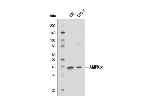 Western Blotting Image 1: AMPKβ1 Antibody