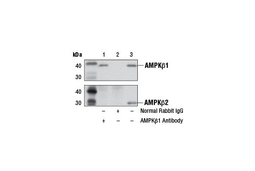 Immunoprecipitation Image 1: AMPKβ1 Antibody