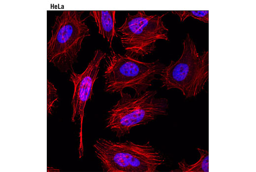 Immunofluorescence Image 1: Tri-Methyl-Histone H3 (Lys4) (C42D8) Rabbit mAb (Alexa Fluor® 647 Conjugate)