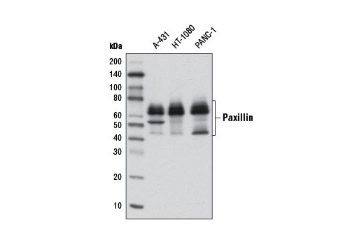  Image 1: PhosphoPlus® Paxillin (Tyr118) Antibody Duet