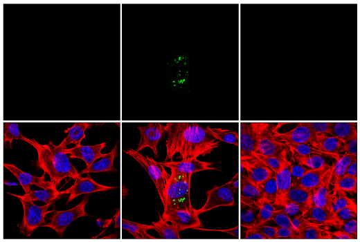 Immunofluorescence Image 1: Phospho-SQSTM1/p62 (Ser349) (E7M1A) Rabbit mAb (Alexa Fluor® 488 Conjugate)