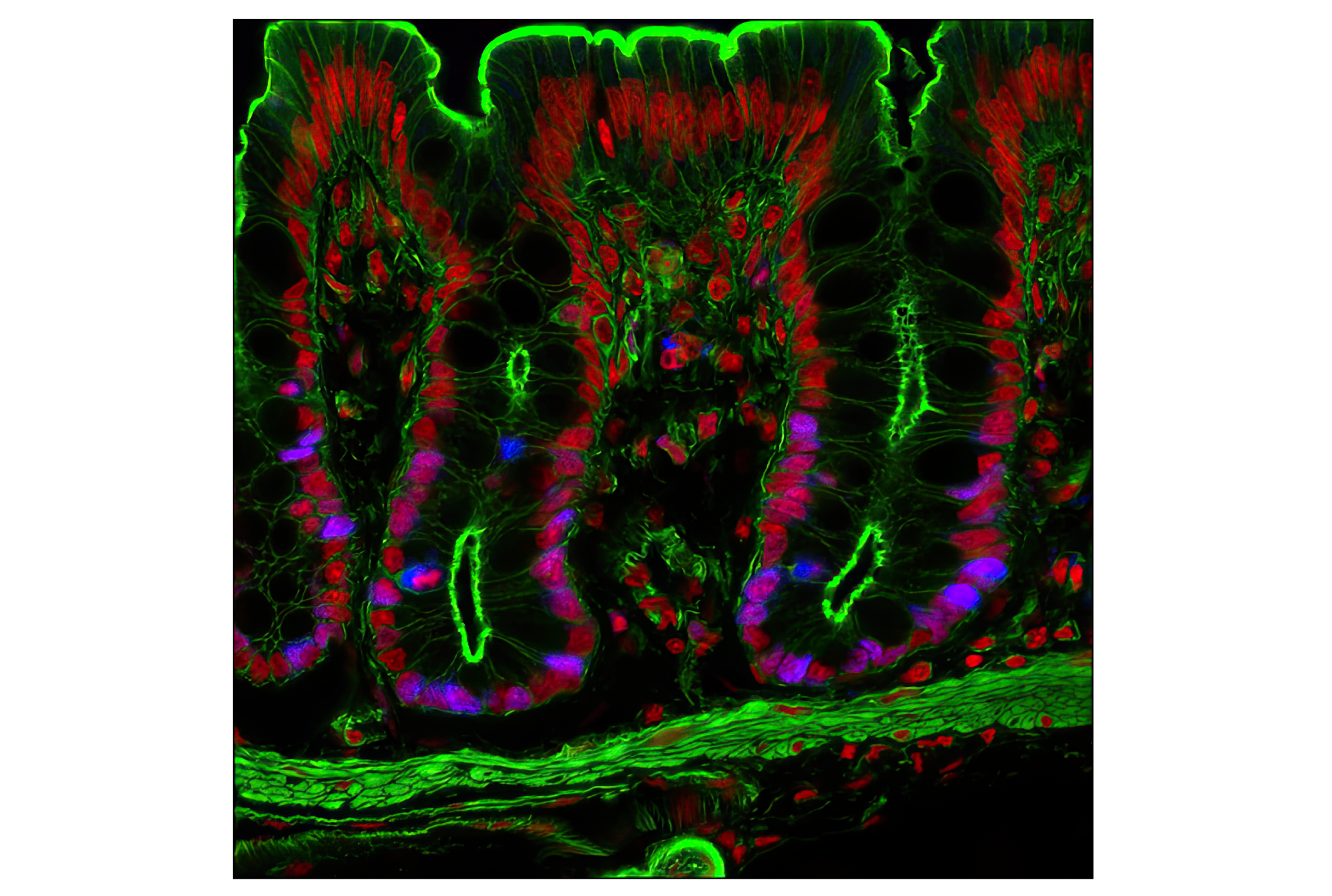 Immunofluorescence Image 1: Ki-67 (D3B5) Rabbit mAb (Alexa Fluor® 647 Conjugate)