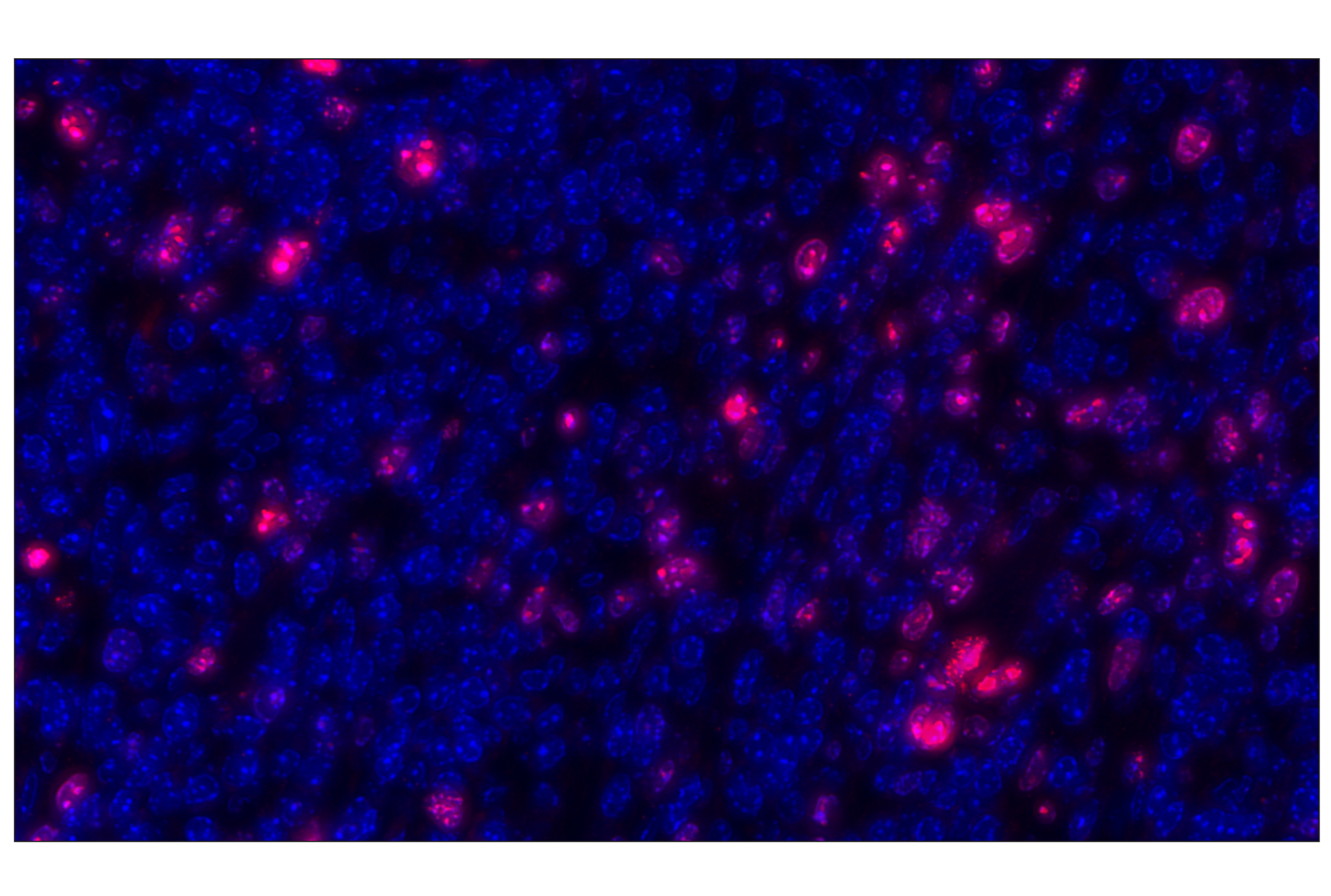 Immunohistochemistry Image 1: Ki-67 (D3B5) Rabbit mAb (Alexa Fluor® 647 Conjugate)