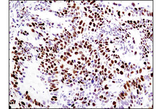 Immunohistochemistry Image 1: MCM2 (1E7) Mouse mAb