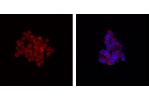 Immunofluorescence Image 1: Phospho-Syk (Tyr525/526) (C87C1) Rabbit mAb (Alexa Fluor® 647 Conjugate)