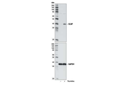 Western Blotting Image 1: SLBP Antibody