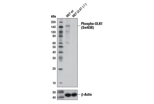 Western Blotting Image 1: Phospho-ULK1 (Ser638) Antibody