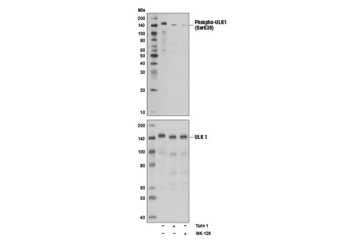 Western Blotting Image 3: Phospho-ULK1 (Ser638) Antibody